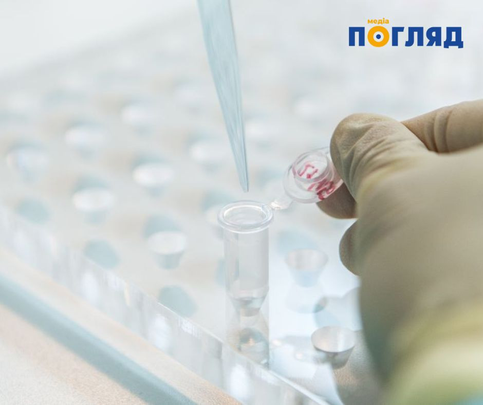 В Україні автоматизували облік і зберігання біологічного матеріалу військових (ФОТО) В Україні автоматизували облік і зберігання біологічного матеріалу військових (ФОТО) - зображення